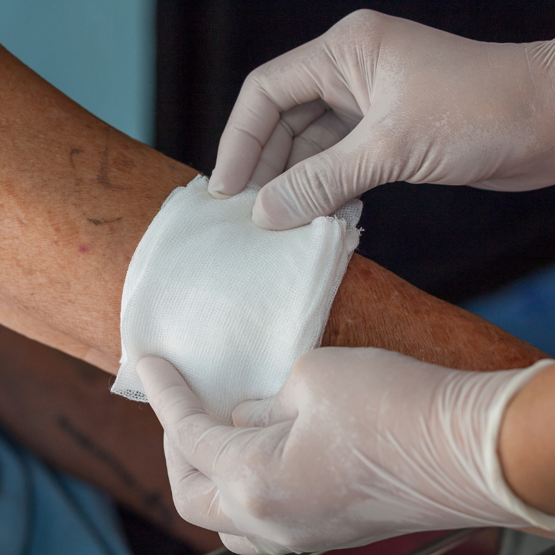 gloved hands dressing an arm wound